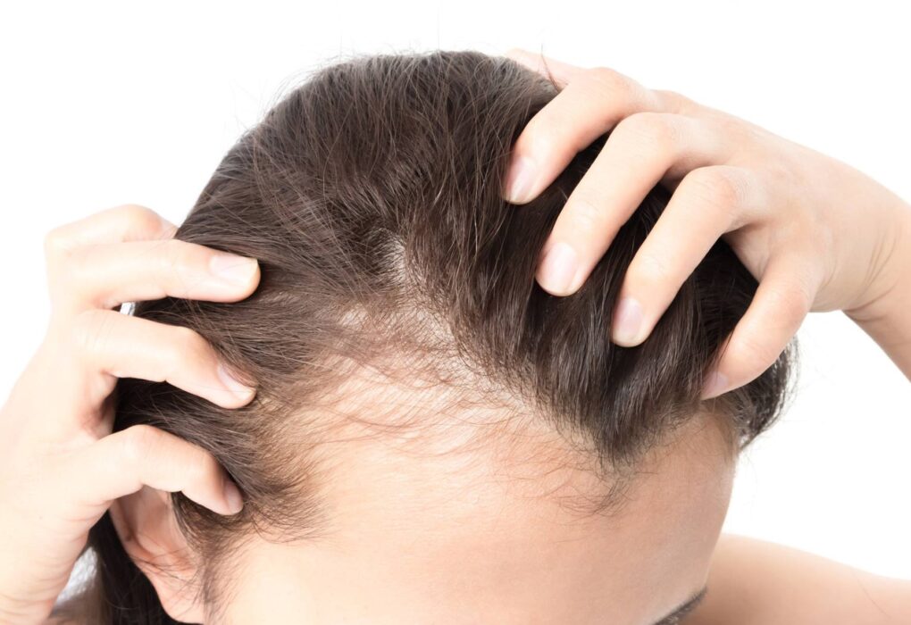 New Jersey hair loss treatment