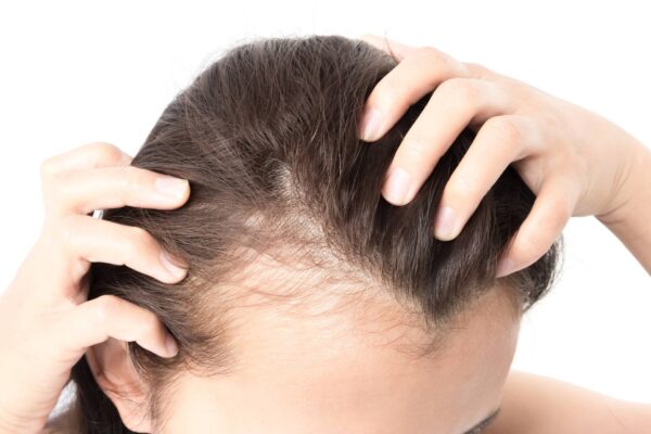 New Jersey hair loss treatment