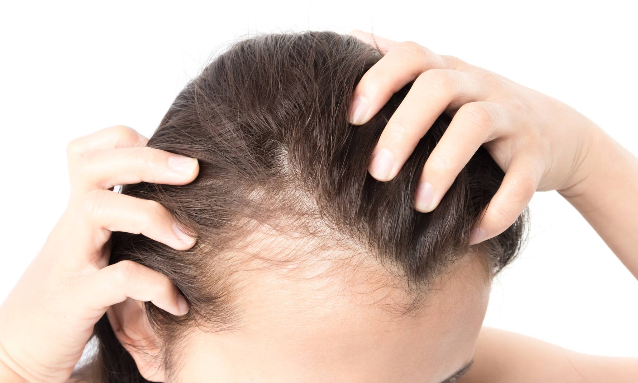 New Jersey hair loss treatment